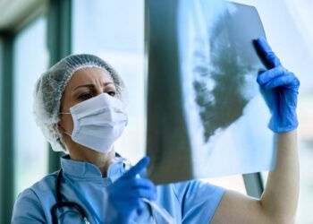 Fibrosis pulmonar idiopática exige diagnóstico temprano