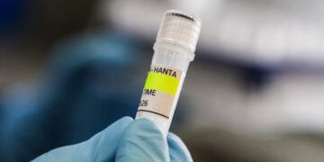 Hantavirus en crucero no se habría originado a bordo