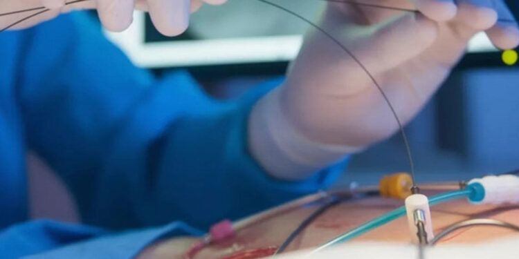 Proponen auditoría de angioplastias en el país