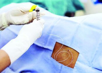 Aseguradora en EE.UU. cancela plan polémico para limitar cobertura de anestesia