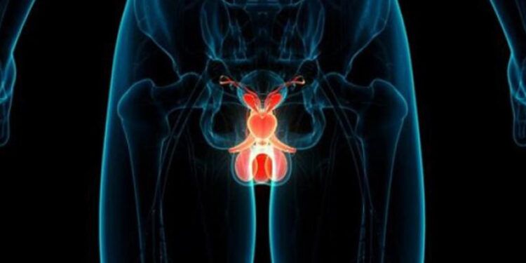 Cáncer de próstata afecta ya a hombres desde los 40 años