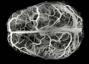 Descubren enfermedad neurológica ultrarrara con solo 13 casos en el mundo