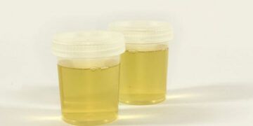 Empresa francesa transforma orina humana en fertilizante sostenible