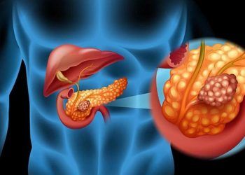 Estudio revela formación de tumor en células del páncreas