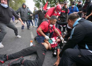 Fotógrafo herido de gravedad en protestas en Buenos Aires