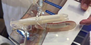 Implante de pene, opción clave tras cáncer de próstata