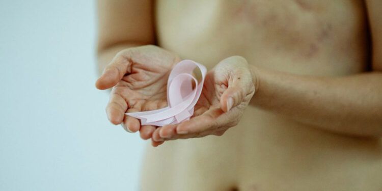 Más de 11 mil dominicanos diagnosticados con cáncer de mama en 2024