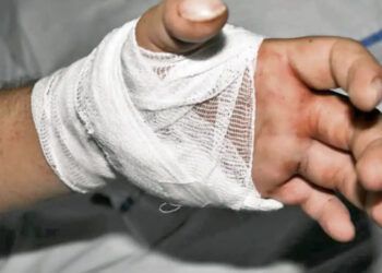 Médicos del Gautier reimplantan nueve manos en lo que va de año