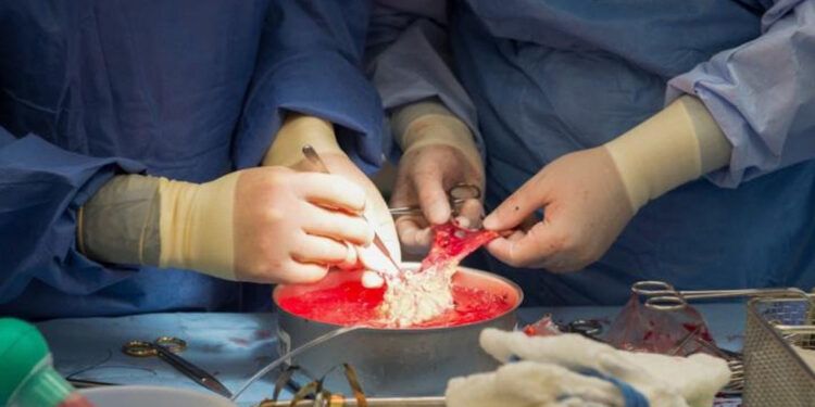 Mujer de Alabama recibe trasplante de riñón de cerdo