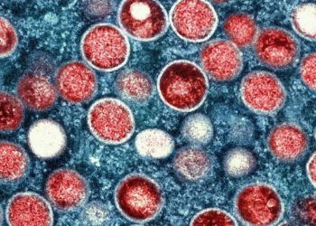 OMS advierte posible aumento de casos de mpox en Europa