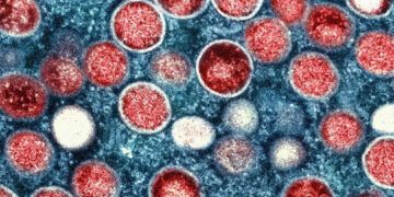 OMS advierte posible aumento de casos de mpox en Europa
