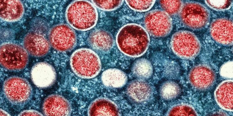 OMS advierte posible aumento de casos de mpox en Europa