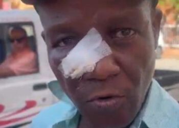 Profesor afirma tiene la nariz fracturada tras agresión
