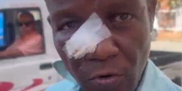 Profesor afirma tiene la nariz fracturada tras agresión