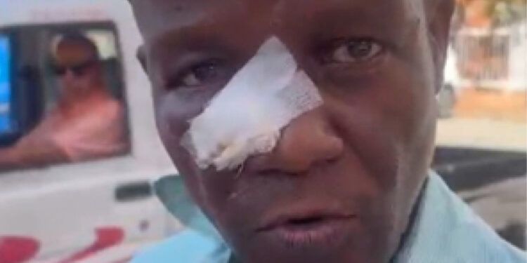Profesor afirma tiene la nariz fracturada tras agresión