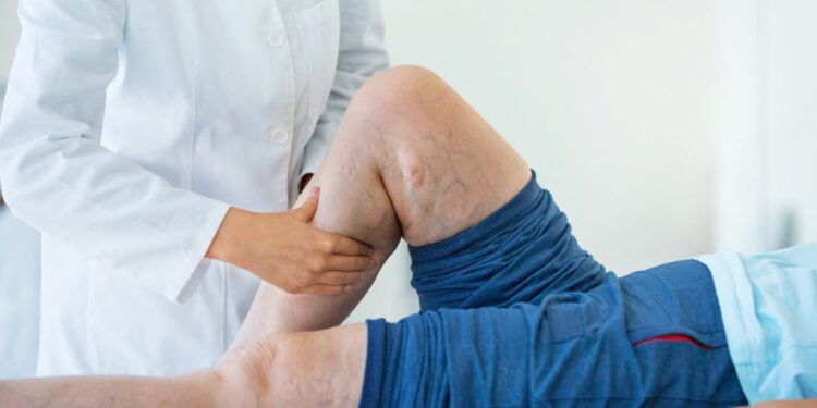 Terapia trombolítica disponible en 30 hospitales del país